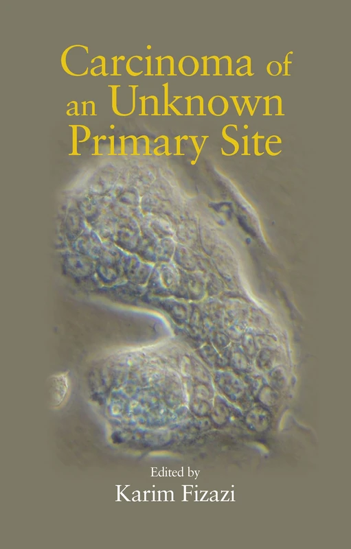 Carcinoma of an Unknown Primary Site