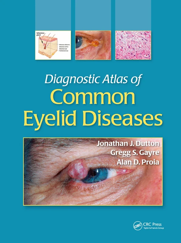 Diagnostic Atlas of Common Eyelid Diseases