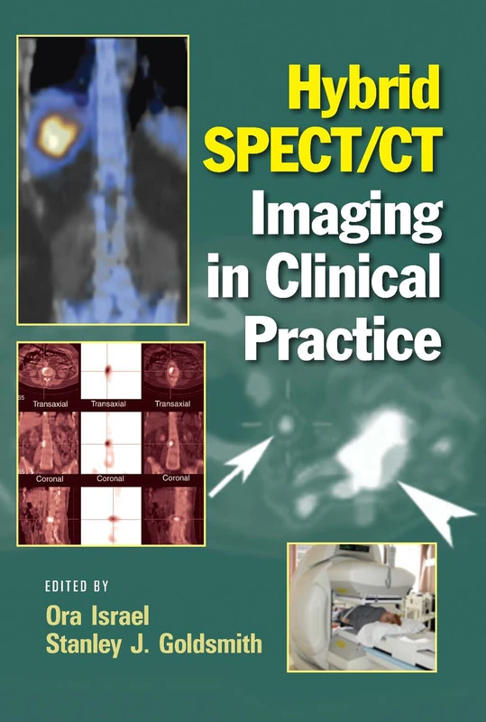 Hybrid SPECT/CT Imaging in Clinical Practice - Image 1