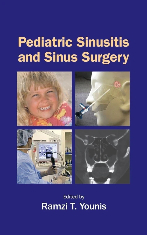 CRC Press Pediatric Sinusitis and Sinus Surgery Reference