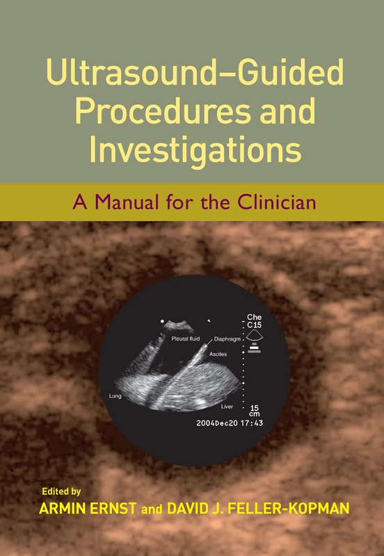 CRC Press Ultrasound-Guided Procedures and Investigations Manual