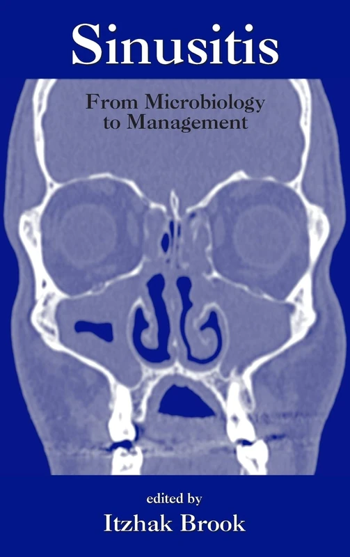 Sinusitis: From Microbiology To Management: 35 (Infectious Disease and Therapy)