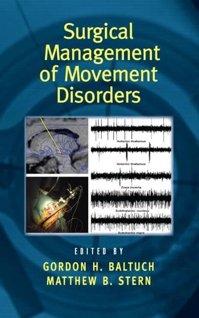Surgical Management of Movement Disorders: 77 (Neurological Disease and Therapy)