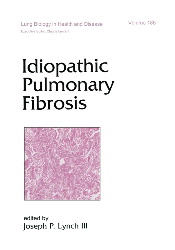 Idiopathic Pulmonary Fibrosis: 185 (Lung Biology in Health and Disease)