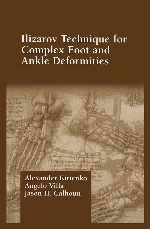 CRC Press Ilizarov Technique for Complex Foot and Ankle Deformities
