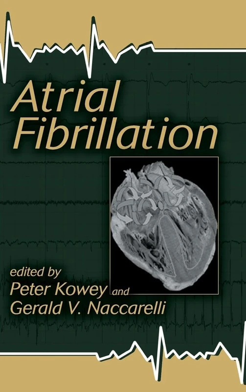Atrial Fibrillation: 50 (Fundamental and Clinical Cardiology)