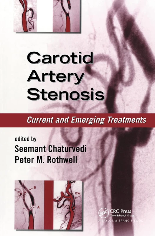 Carotid Artery Stenosis: Current and Emerging Treatments (Neurological Disease and Therapy)