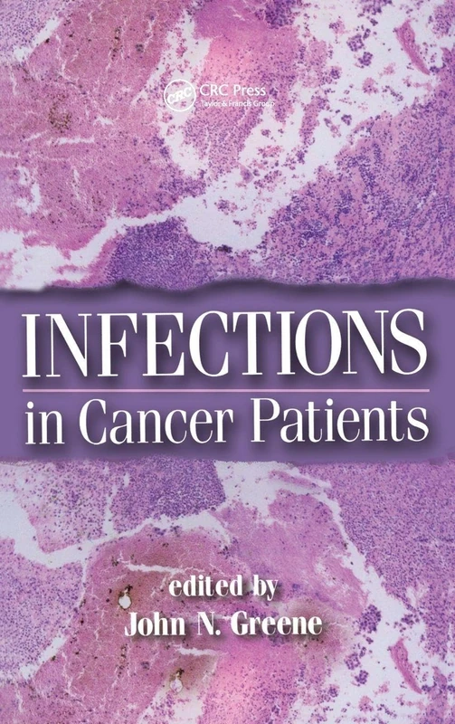 CRC Press Infections in Cancer Patients: 29 (Oncology Book)