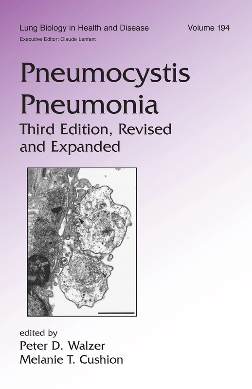 CRC Press Pneumocystis Pneumonia - Lung Biology in Health and Disease