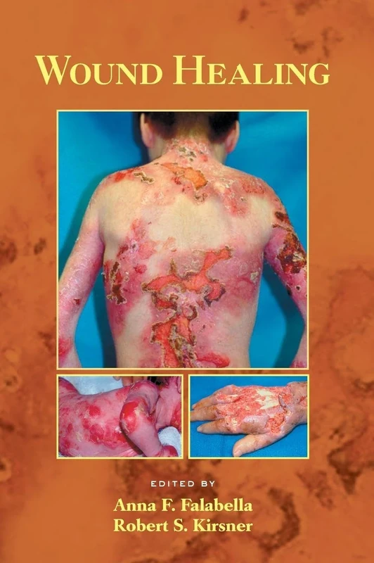 Wound Healing: 34 (Basic and Clinical Dermatology)