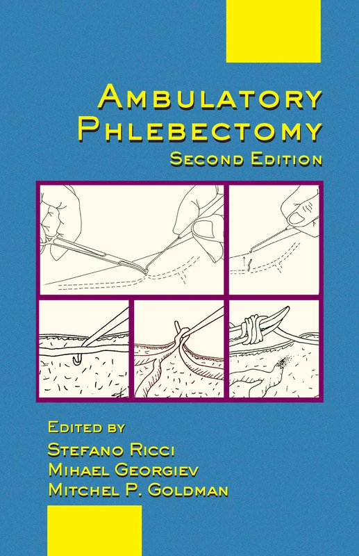 CRC Press Ambulatory Phlebectomy - Second Edition Guide