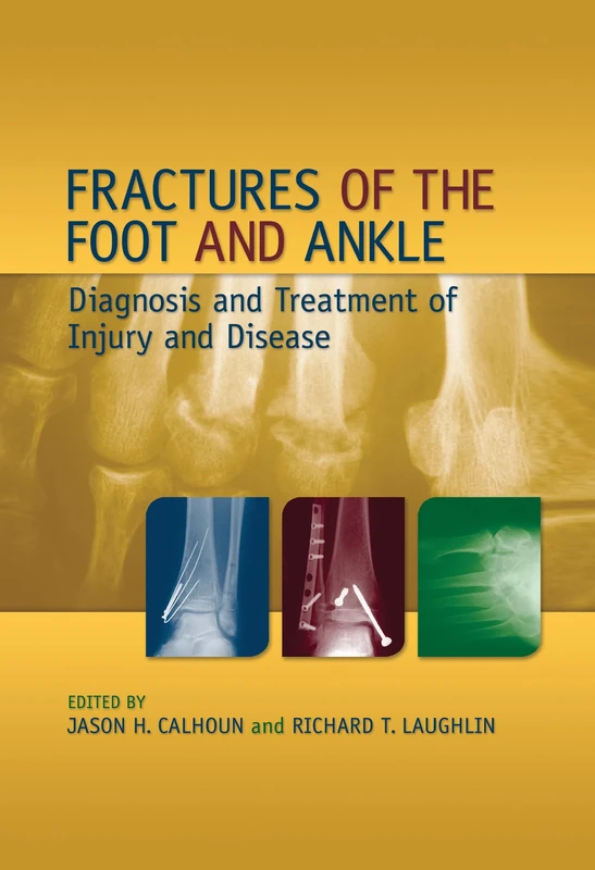 Fractures of the Foot and Ankle: Diagnosis and Treatment of Injury and Disease