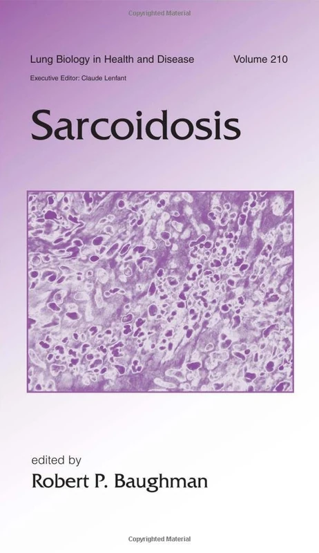CRC Press Sarcoidosis: 210 (Lung Biology in Health and Disease)