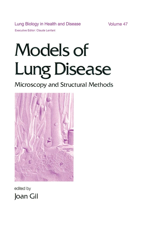 Models of Lung Disease: Microscopy and Structural Methods: 47 (Lung Biology in Health and Disease)