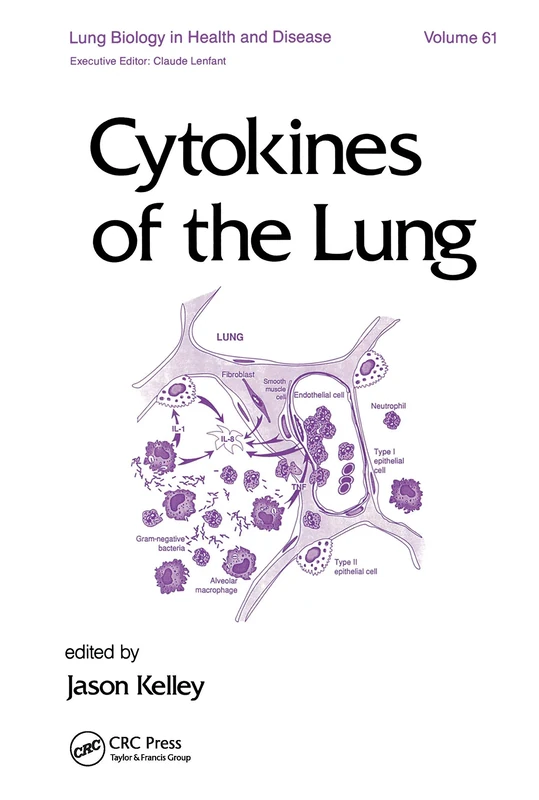 Cytokines of the Lung: 61 (Lung Biology in Health and Disease)