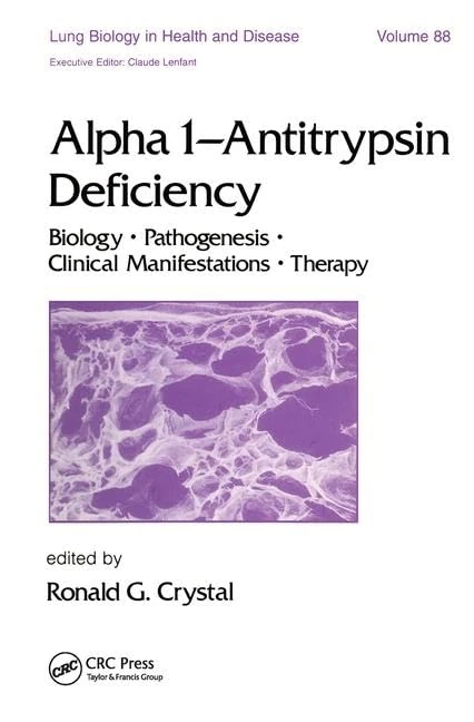 Alpha 1 - Antitrypsin Deficiency: Biology-Pathogenesis-Clinical Manifestations-Therapy: 88 (Lung Biology in Health and Disease)