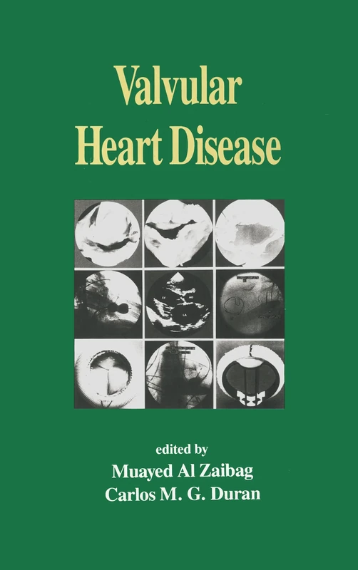 Valvular Heart Disease: 20 (Fundamental and Clinical Cardiology)