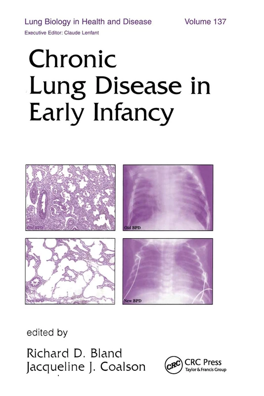 Chronic Lung Disease in Early Infancy: 137 (Lung Biology in Health and Disease)