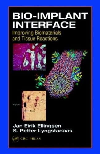 Bio-Implant Interface: Improving Biomaterials and Tissue Reactions