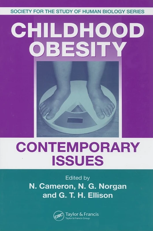Childhood Obesity: Contemporary Issues: 44 (Society for the Study of Human Biology)