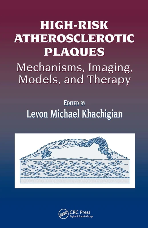 High-Risk Atherosclerotic Plaques: Mechanisms, Imaging, Models, and Therapy