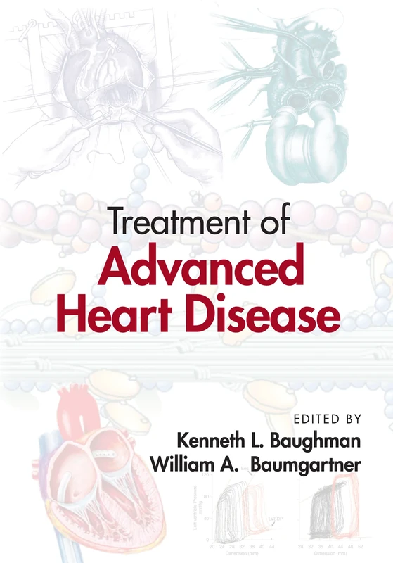 Treatment of Advanced Heart Disease: 56 (Fundamental and Clinical Cardiology)