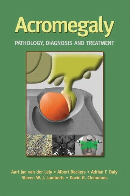 CRC Press Acromegaly: Pathology, Diagnosis and Treatment Book