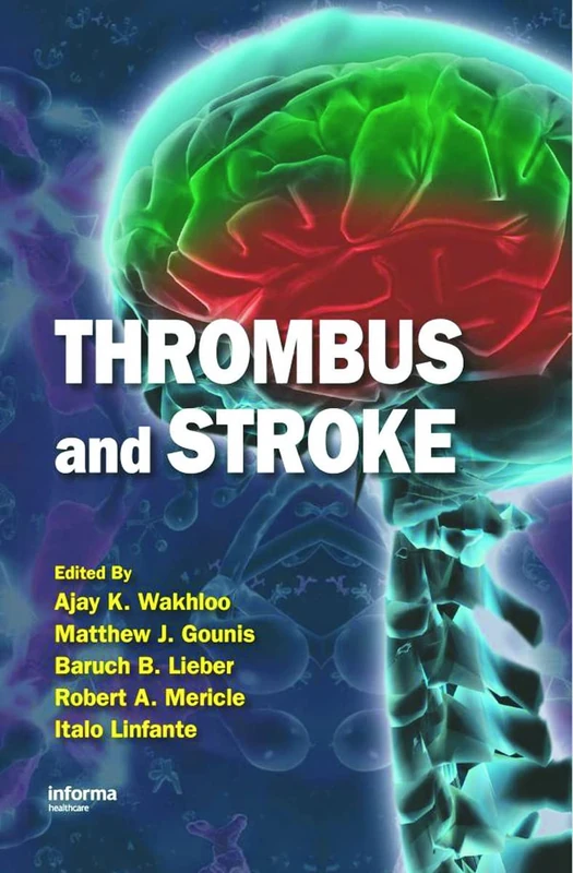 Thrombus and Stroke (Neurological Disease and Therapy)
