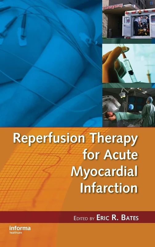 Reperfusion Therapy for Acute Myocardial Infarction: 64 (Fundamental and Clinical Cardiology)