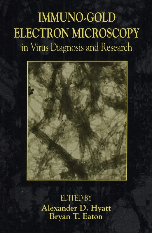 Immuno-Gold Electron Microscopy in Virus Diagnosis and Research