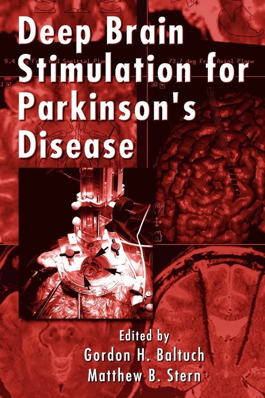 Deep Brain Stimulation for Parkinson's Disease: 91 (Neurological Disease and Therapy)