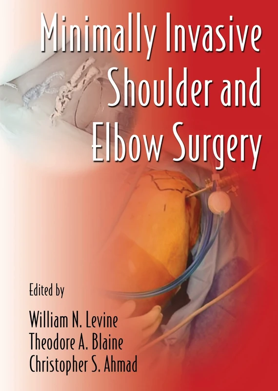 Minimally Invasive Shoulder and Elbow Surgery: 1 (Minimally Invasive Procedures in Orthopaedic Surgery)