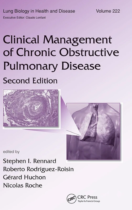 Clinical Management of Chronic Obstructive Pulmonary Disease: 222 (Lung Biology in Health and Disease)