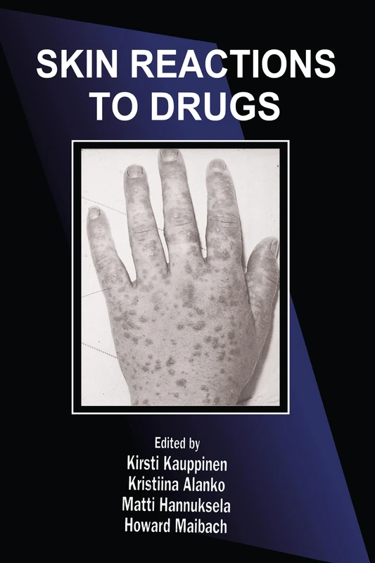 Skin Reactions to Drugs: 15 (Dermatology: Clinical & Basic Science)
