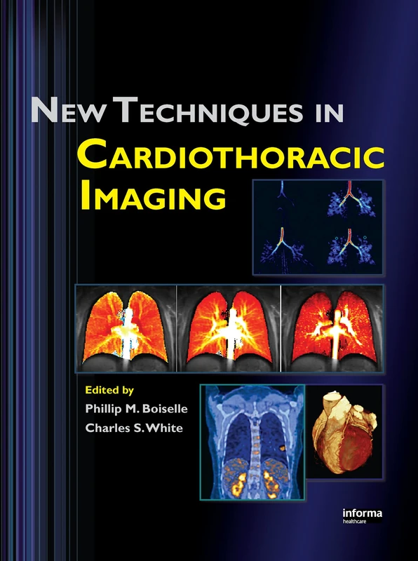 New Techniques in Cardiothoracic Imaging