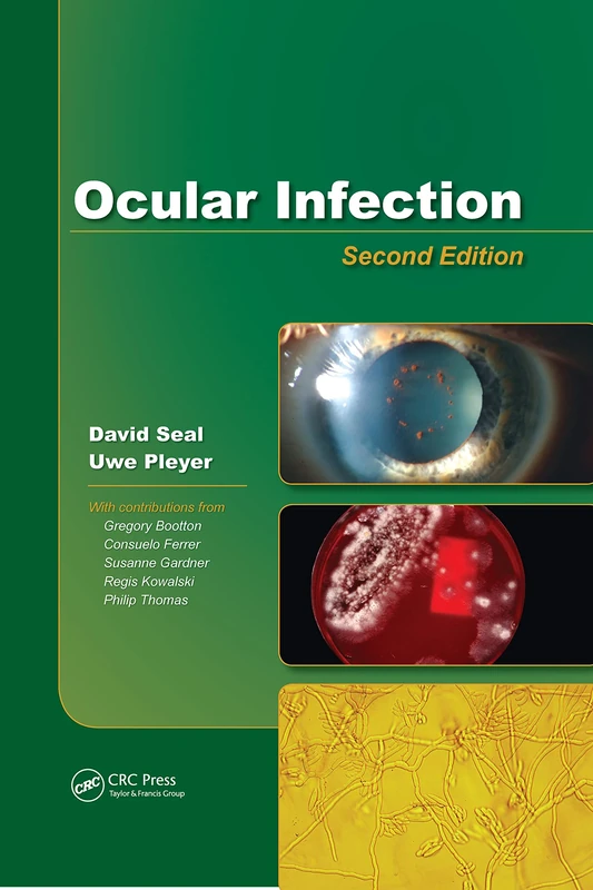 Ocular Infection: Investigation and Treatment in Practice