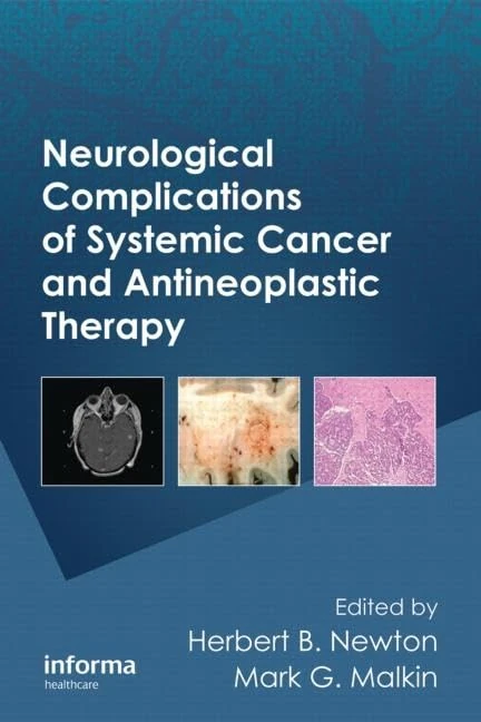 Neurological Complications of Systemic Cancer and Antineoplastic Therapy: 96 (Neurological Disease and Therapy)