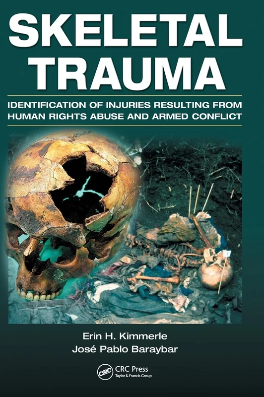 Skeletal Trauma: Identification of Injuries Resulting from Human Rights Abuse and Armed Conflict