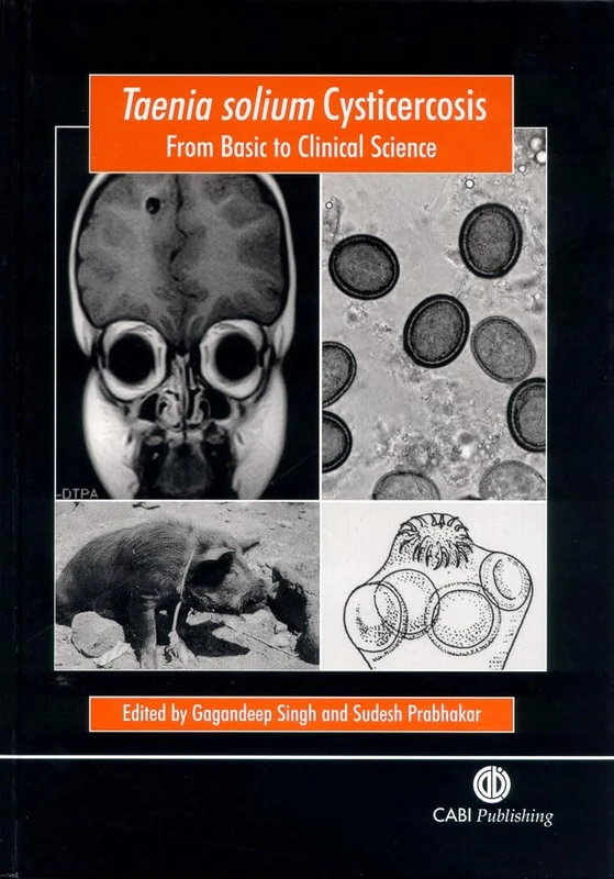 Taenia Solium Cysticerosis: From Basic to Clinical Science (Cabi Publishing)