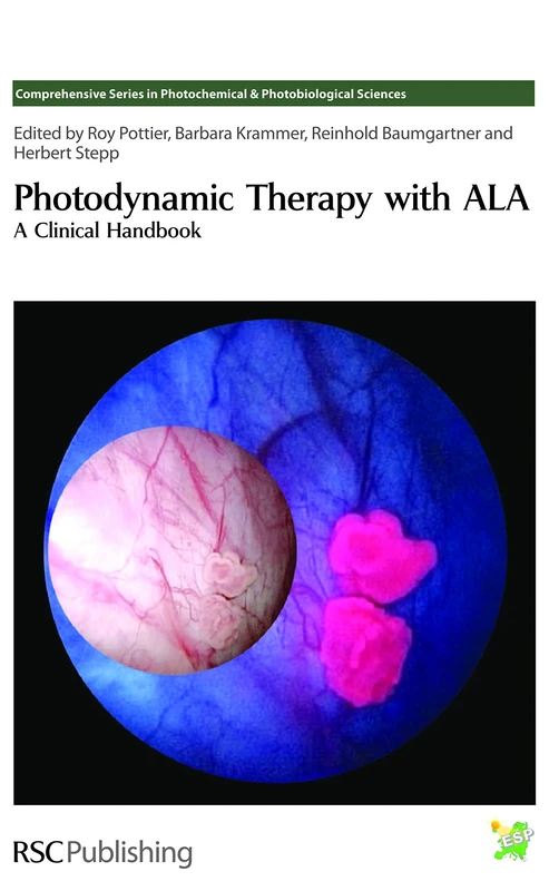 Photodynamic Therapy with ALA: A Clinical Handbook: Volume 7 (Comprehensive Series in Photochemical & Photobiological Sciences)