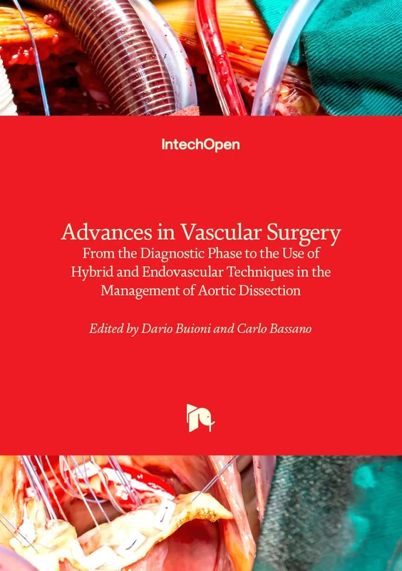 Advances in Vascular Surgery - From the Diagnostic Phase to the Use of Hybrid and Endovascular Techniques in the Management of Aortic Dissection