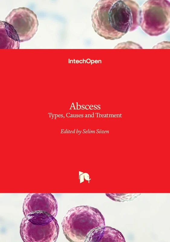 Abscess: Types, Causes and Treatment