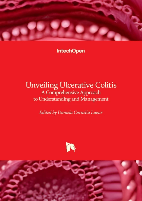Unveiling Ulcerative Colitis - A Comprehensive Approach to Understanding and Management