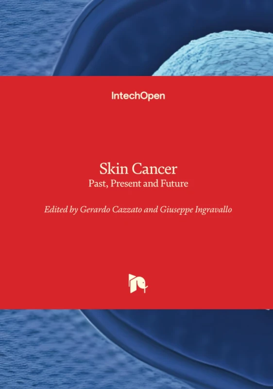 Skin Cancer - Past, Present and Future