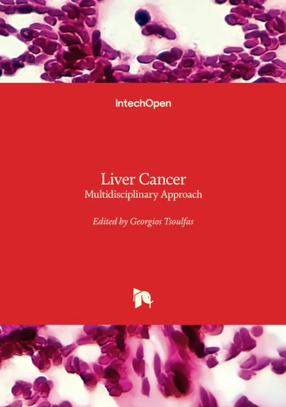 Liver Cancer - Multidisciplinary Approach