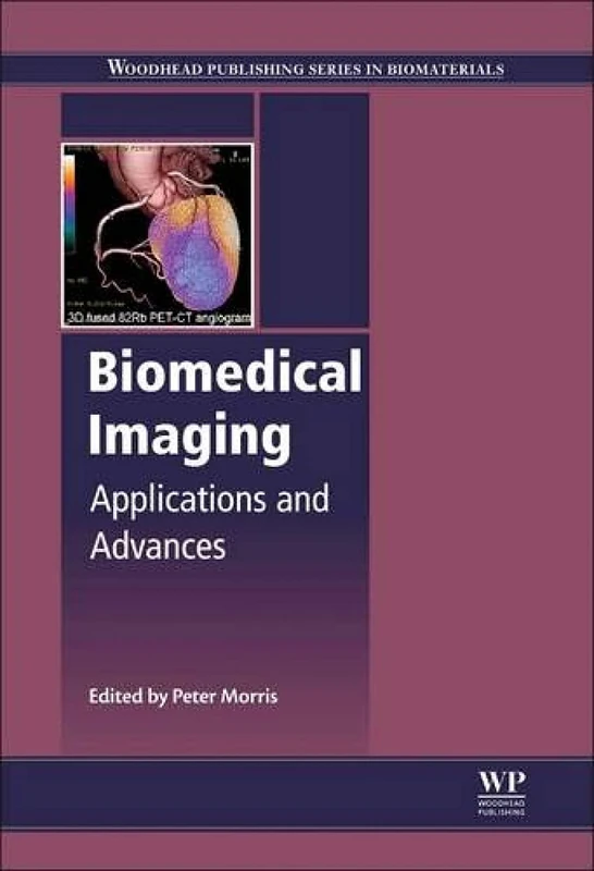 Biomedical Imaging: Applications and Advances (Woodhead Publishing Series in Biomaterials)