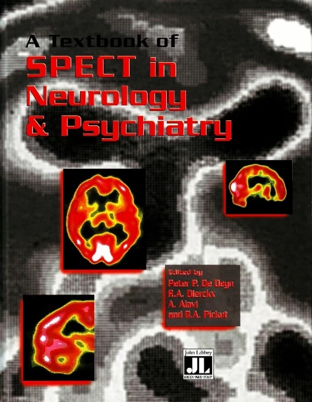 A Textbook of SPECT: In Neurology and Psychiatry