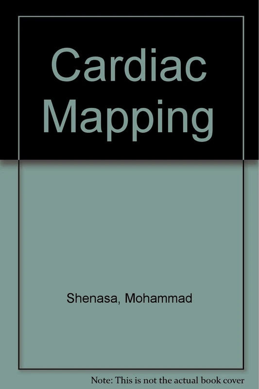 Cardiac Mapping