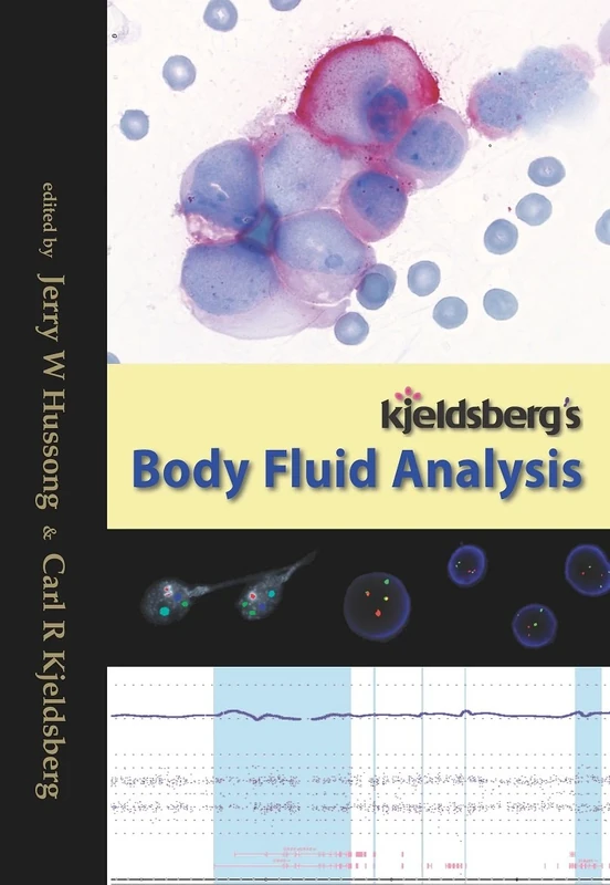 Kjeldsbergaes Body Fluid Analysis