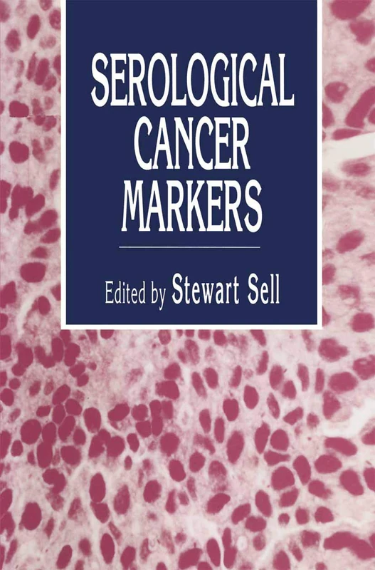Serological Cancer Markers: 11 - Humana Biomedicine Book